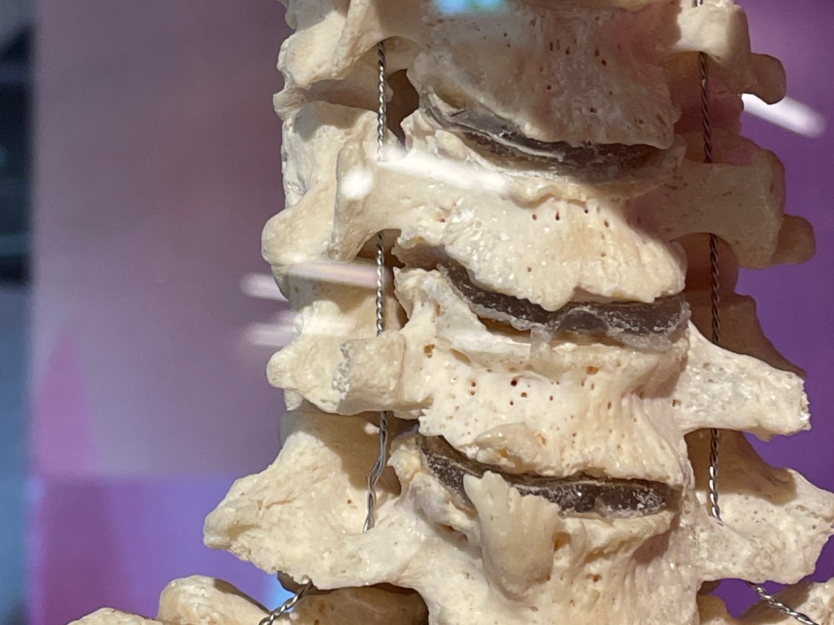 Keine Angst vor Osteochondrose! Ursachen, Symptome, Beschwerden&nbsp;lindern.