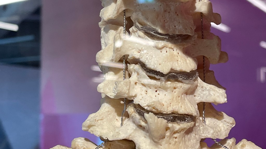 Keine Angst vor Osteochondrose! Ursachen, Symptome, Beschwerden lindern.